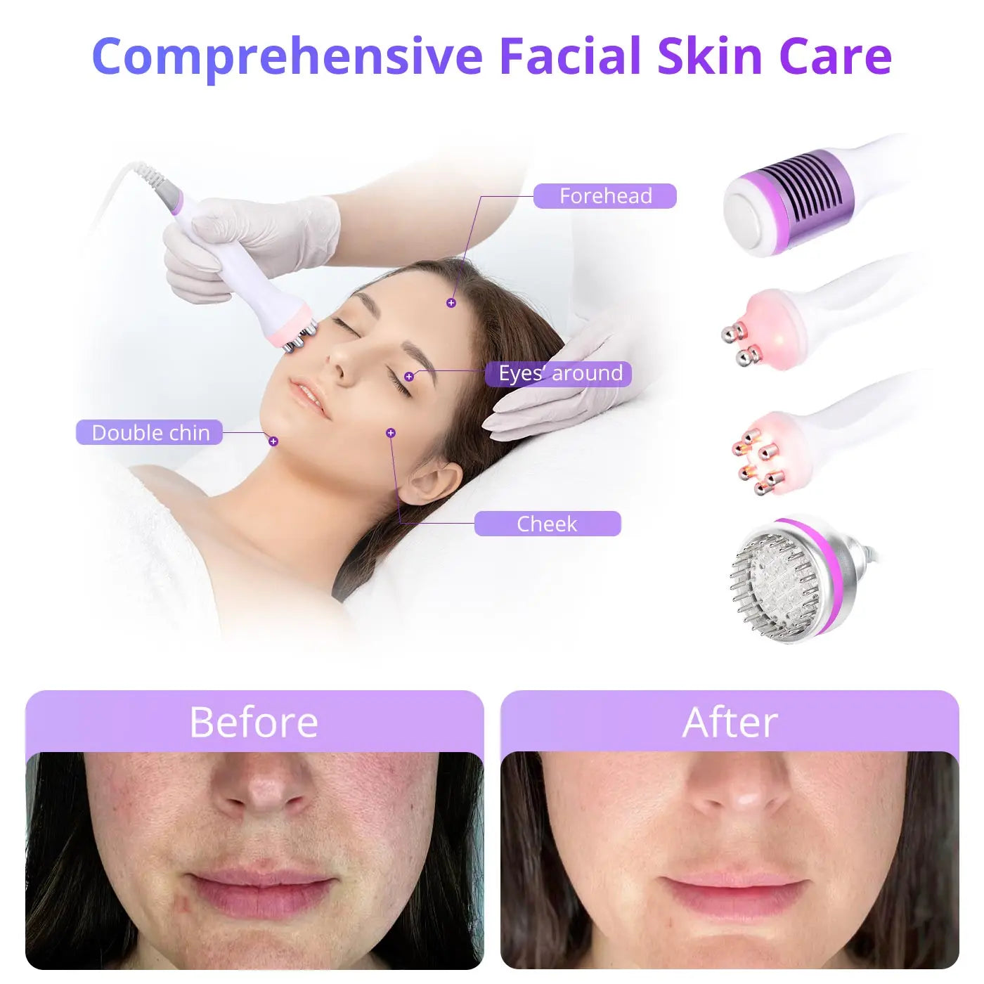 Aristorm cavitation 40k machine skin tightening Cavitation 9 in1 skin tightening tool facial stimulation machine